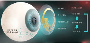 포스텍 연구팀, 녹내장 안압 진단ㆍ치료 스마트 콘택트렌즈 개발