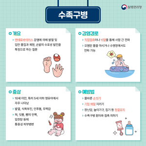 경산시, 영유아 수족구병 주의 당부