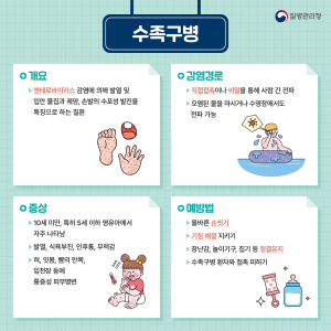 상주시보건소, 어린이 수족구병 발병 주의 철저