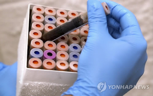 “‘치매’진단, 간단해진다”